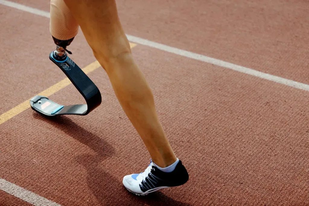 Personalizacja protez kończyn dolnych